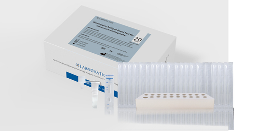 Prove rapide Kit Immunochromatography Method del corredo 20 della prova dell'antigene di Monkeypox