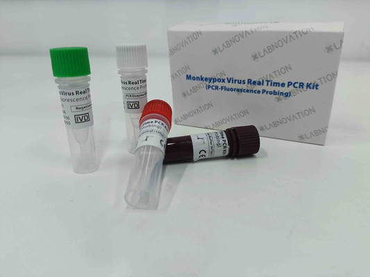 Campioni rapidi dell'essudato della lesione del siero di Kit Real Time For Human della prova di PCR del virus di Monkeypox